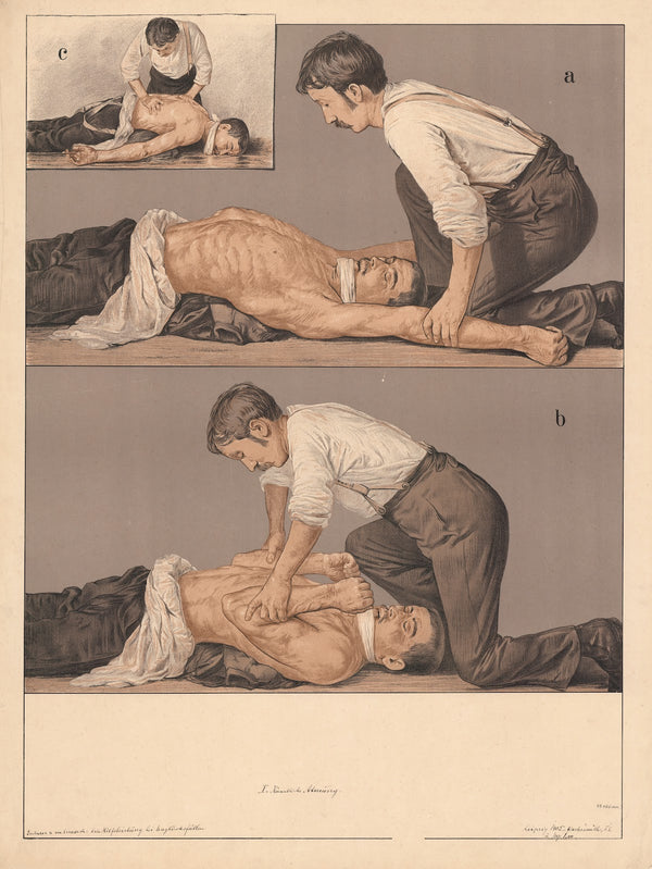 Künstlische Atmung 1911