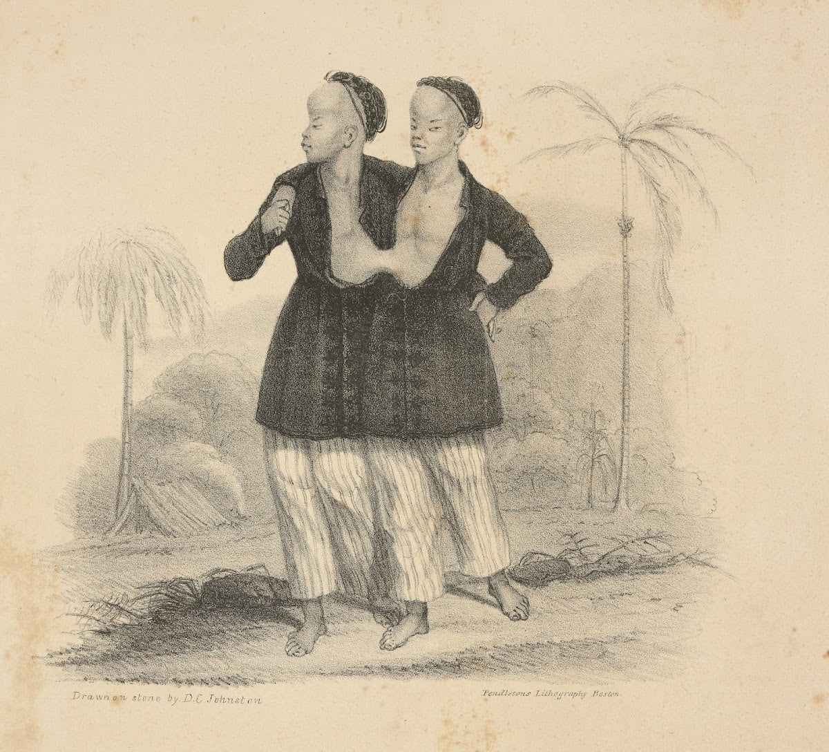 The Siamese boys Aged 18 1829