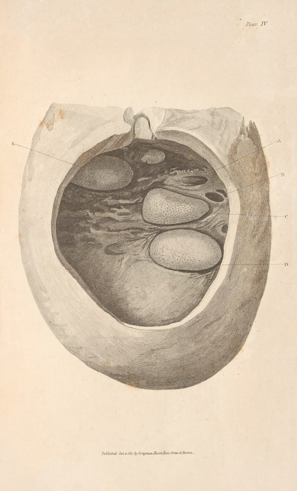 An Essay on the Chemical History and Medical Treatment of Calculous Disorders Pl