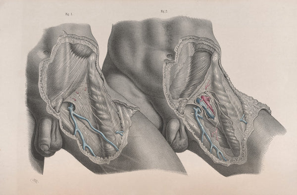 Surgical anatomy Pl27 1856