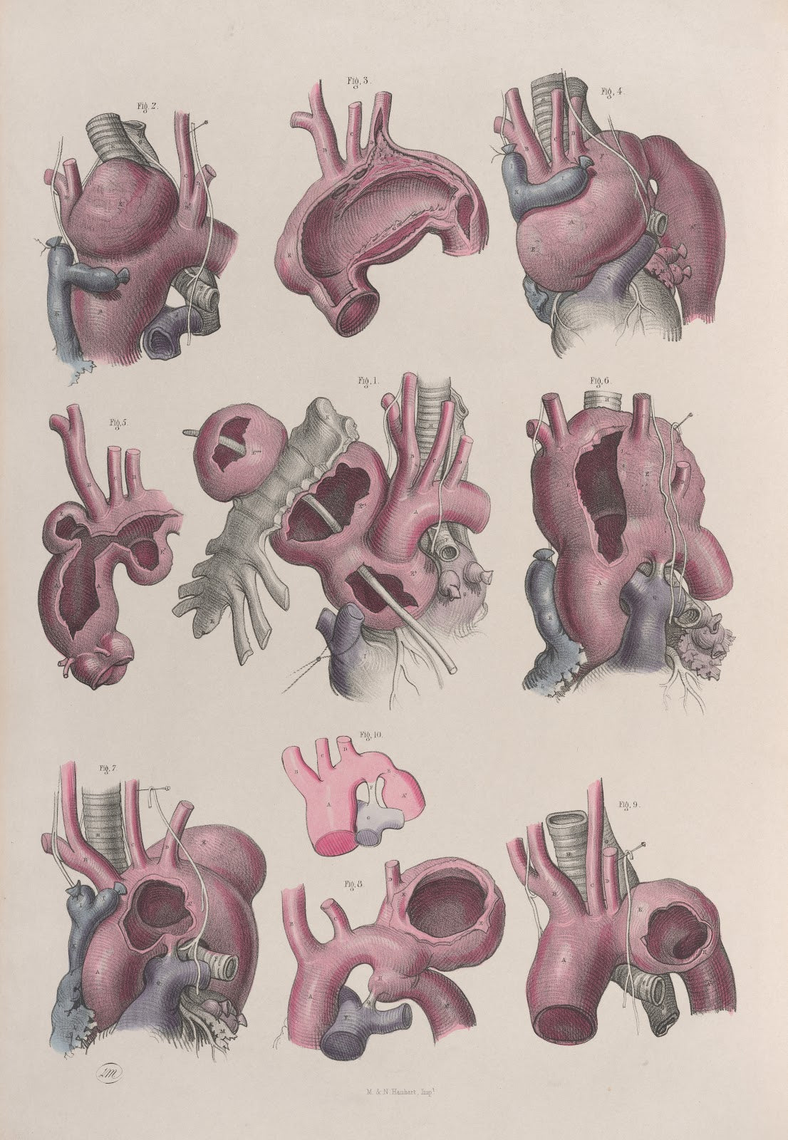 Surgical anatomy Pl15 1856