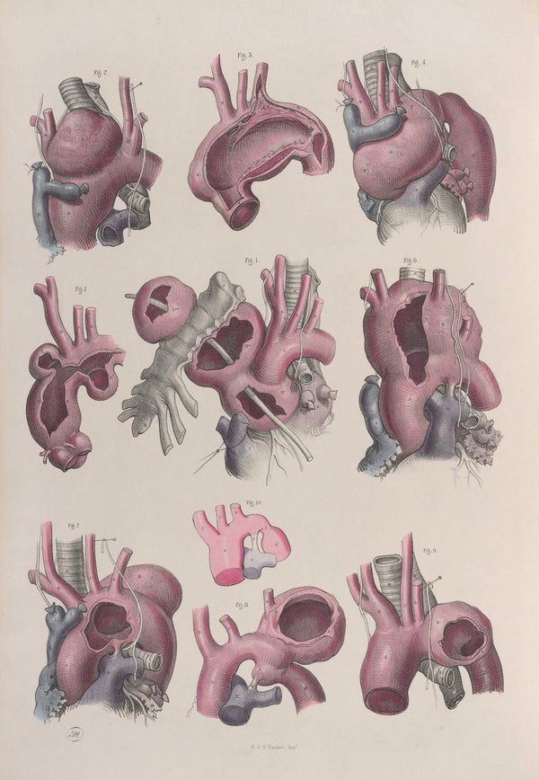 Surgical anatomy Pl15 1856