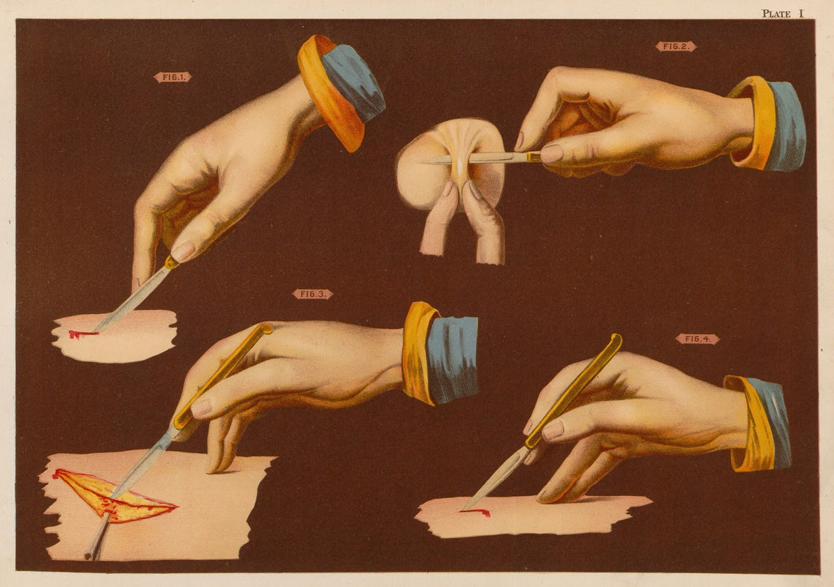 Methods of holding the bistoury 1889