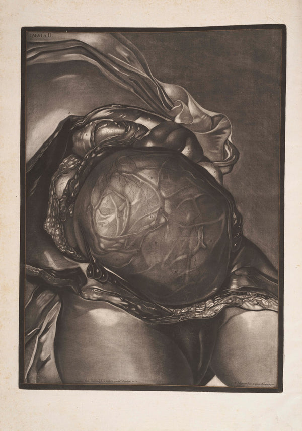 The Abdomen laid open with the Uterus injected and displayed immediately as laid
