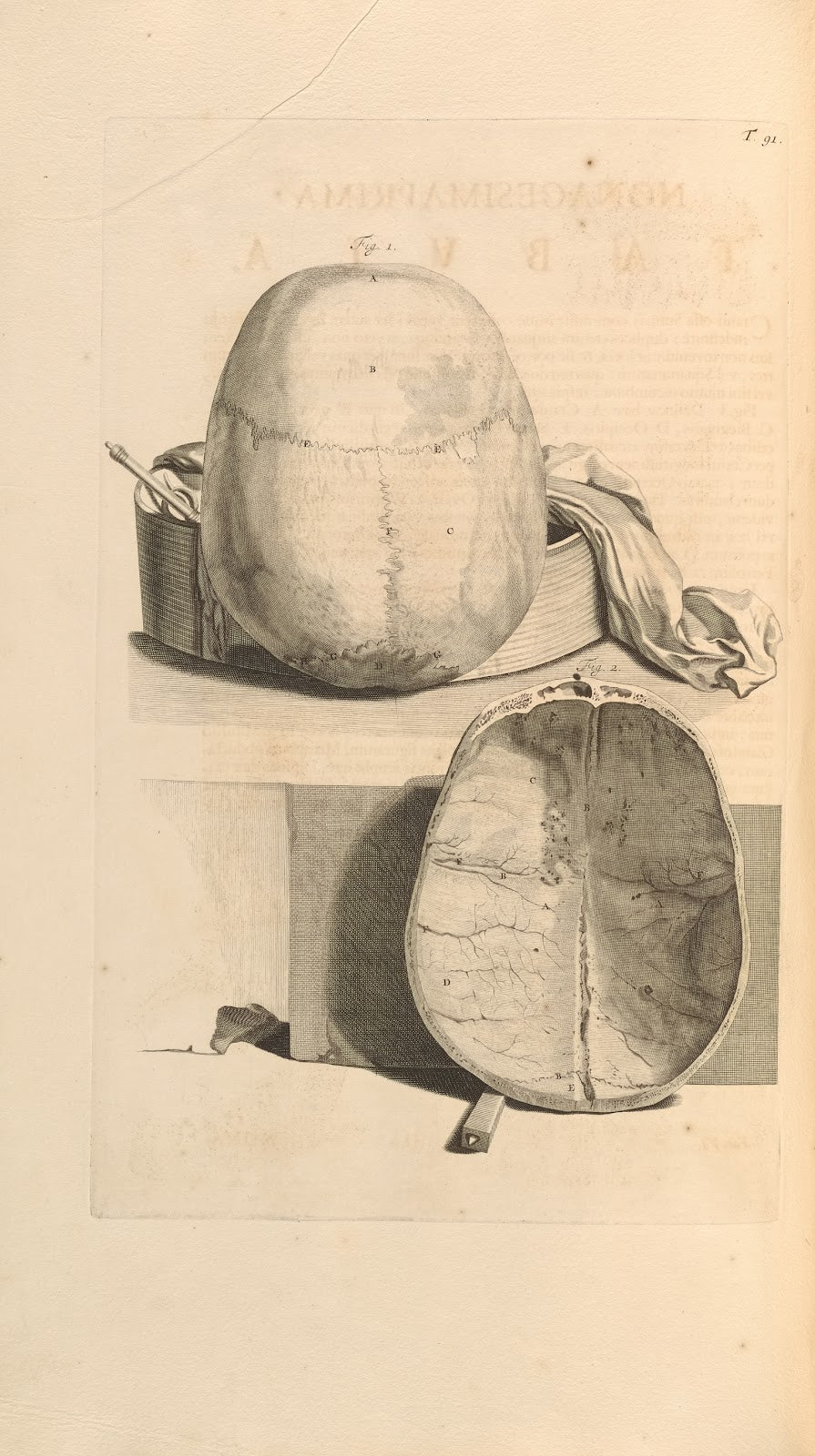 Anatomia humani corporis Pl092 1685
