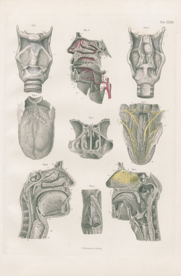 The larynx with sections of nasal cavity and mouth the tongue and fauces 1880