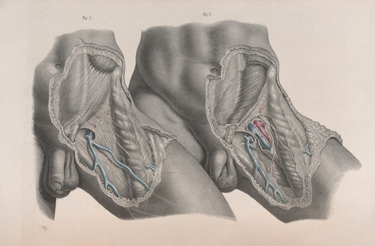 Surgical anatomy Pl27 1856